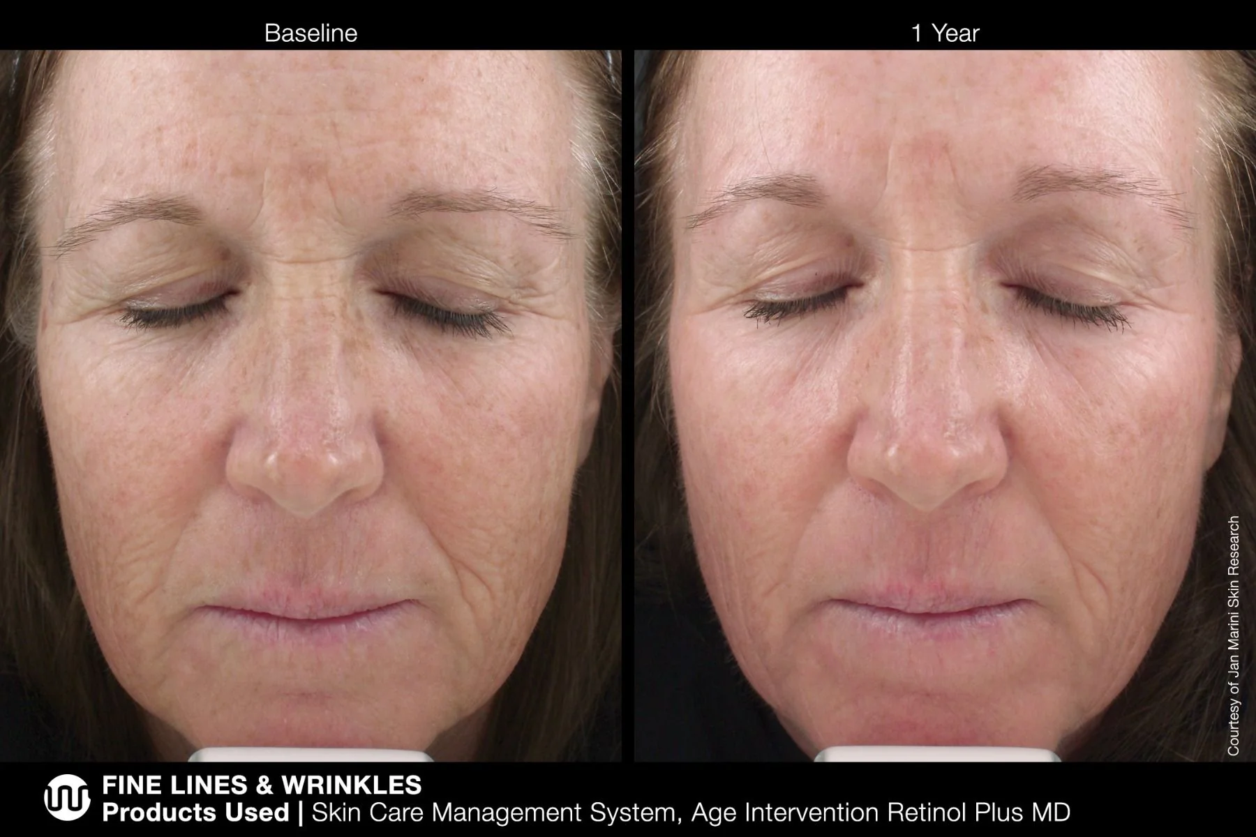 Age Intervention Retinol Plus MD Jan Marini 28g - Image 5