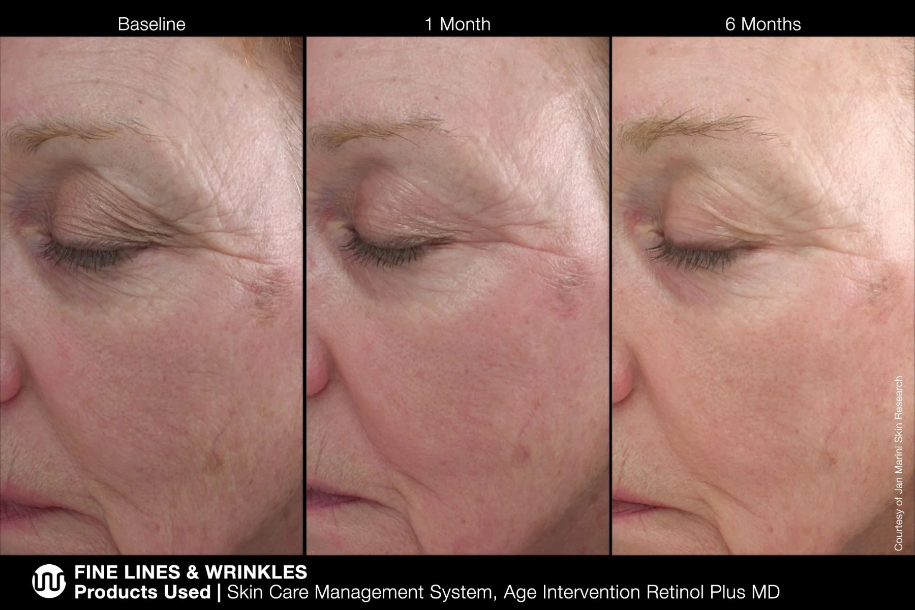 Age Intervention Retinol Plus MD Jan Marini 28g - Image 6