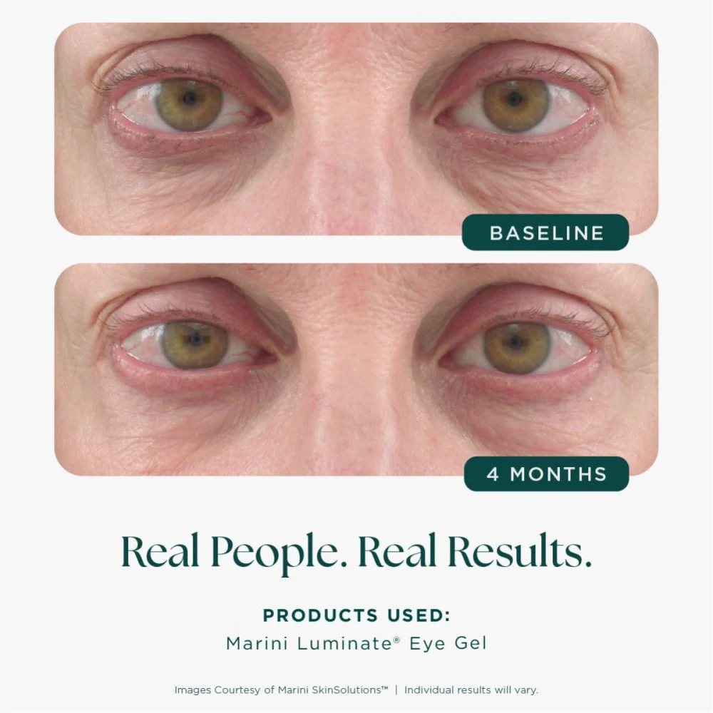 Marini Luminate Eye Gel Jan Marini 15ml - Image 4