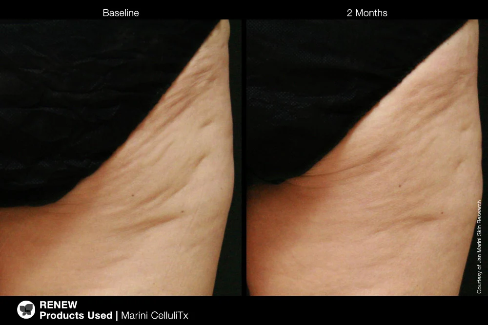 Marini CelluliTx Cellulite Cream Jan Marini 114g - Image 3