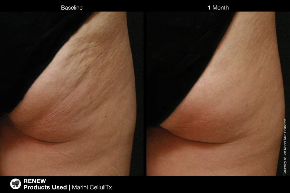 Marini CelluliTx Cellulite Cream Jan Marini 114g - Image 4