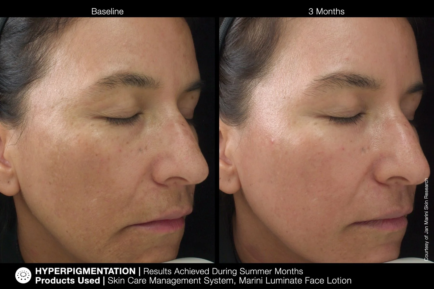 Marini Luminate Face Lotion Jan Marini 30ml - Image 4