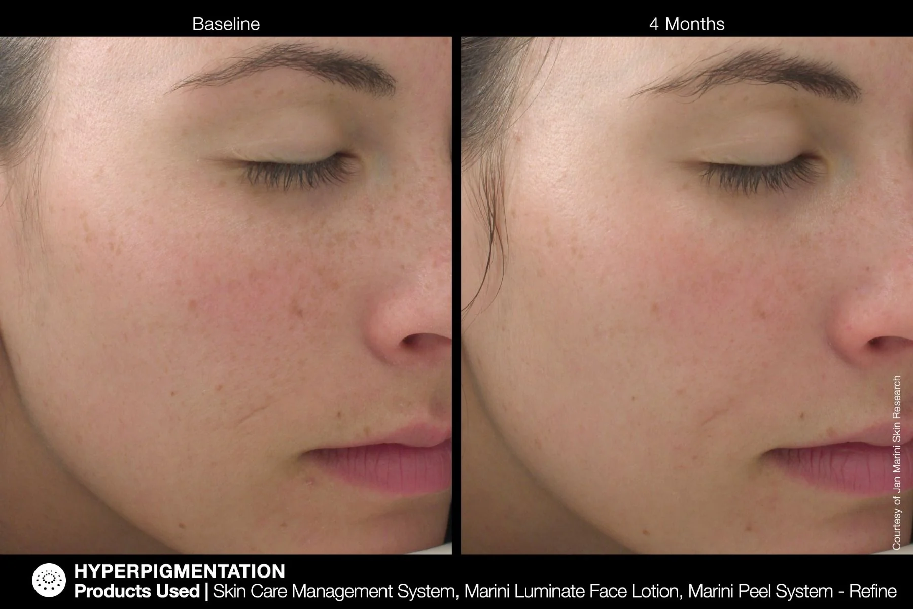 Marini Luminate Face Lotion Jan Marini 30ml - Image 5