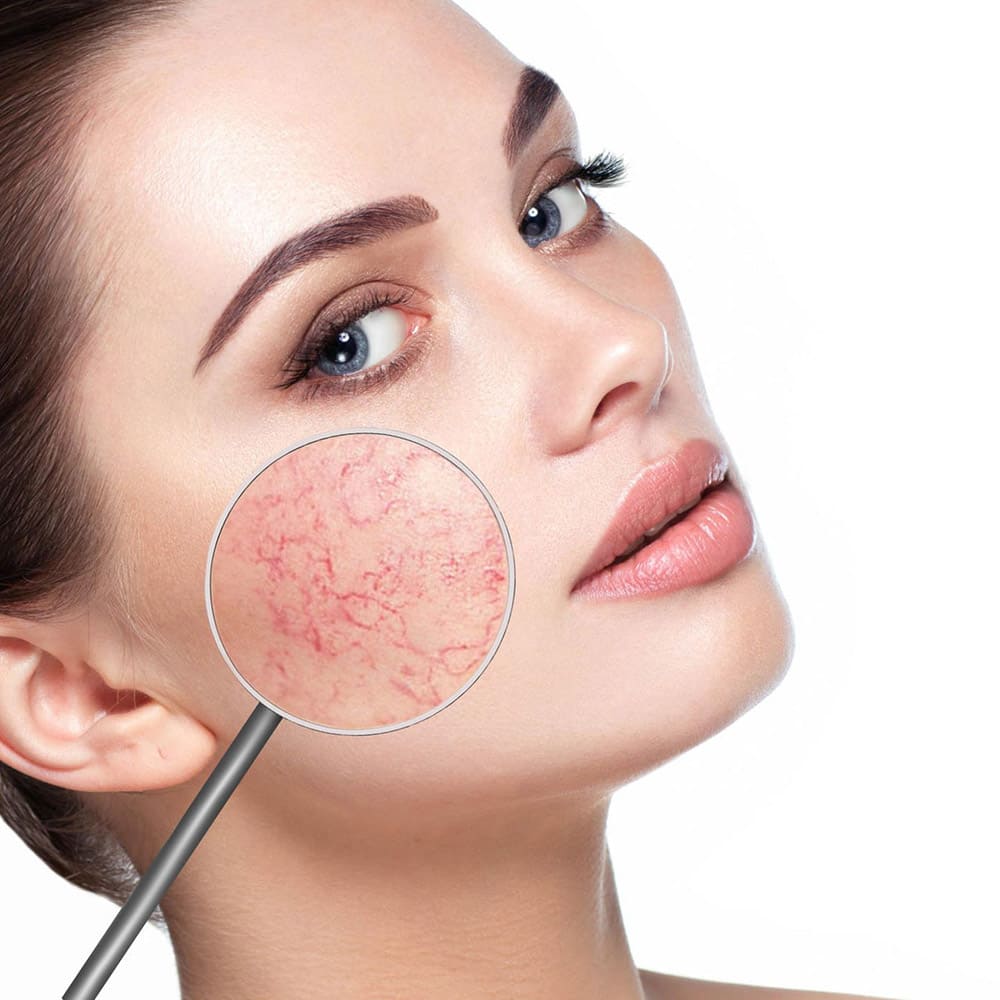 Couperose therapy cream REVIDERM 50ml - Image 3